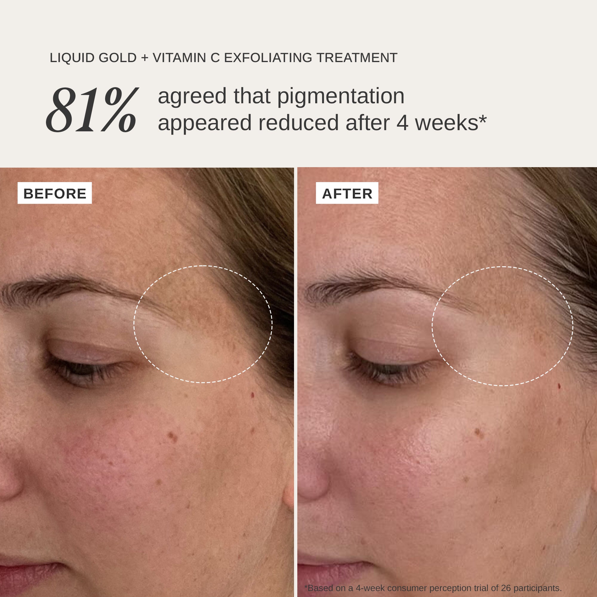 Liquid Gold + Vitamin C Trial Kit