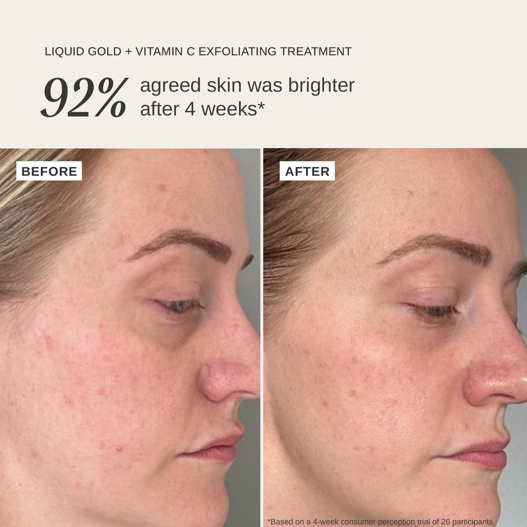 Liquid Gold + Vitamin C Trial Kit
