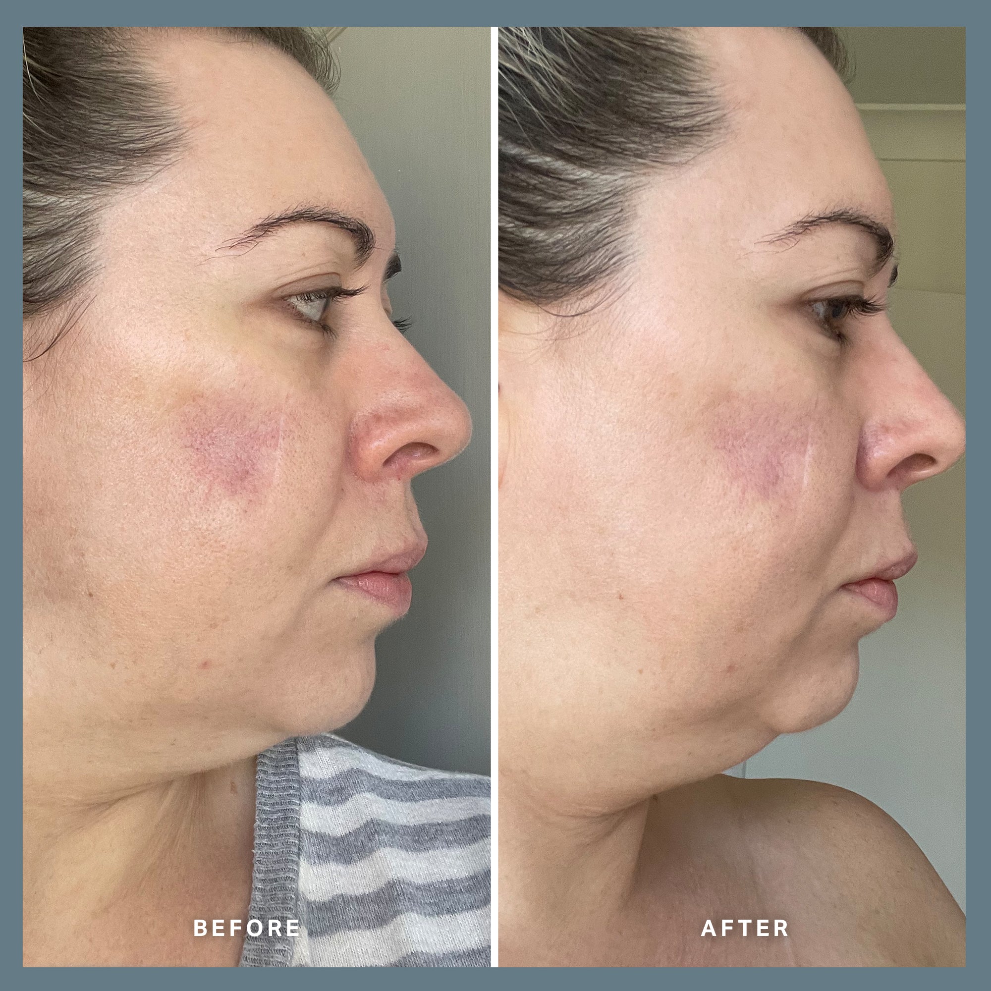 Vitamin A Serum with 0.3% Retinol + 1% Bio-Retinol 25ml